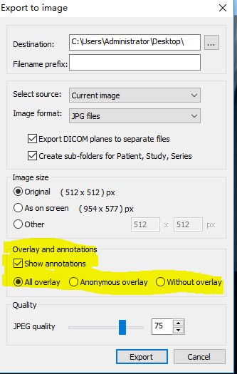 Dicom文件查看器下載