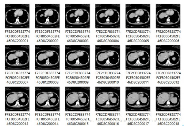 Dicom文件查看器下載