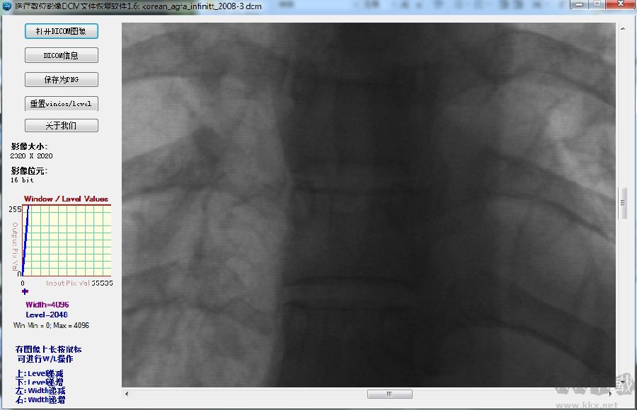 醫(yī)療數(shù)位影像DCM文件恢復(fù)軟件v1.6