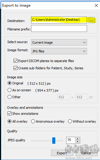 MicroDicom(醫(yī)學(xué)看圖軟件)